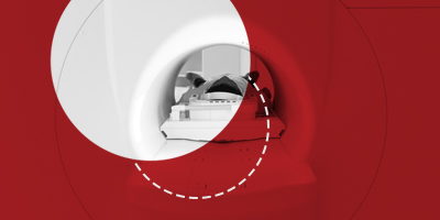  Kompiuterinė tomografija (KT)